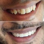 بهترین دندانپزشکی در کیش دکتر مریم آقائی